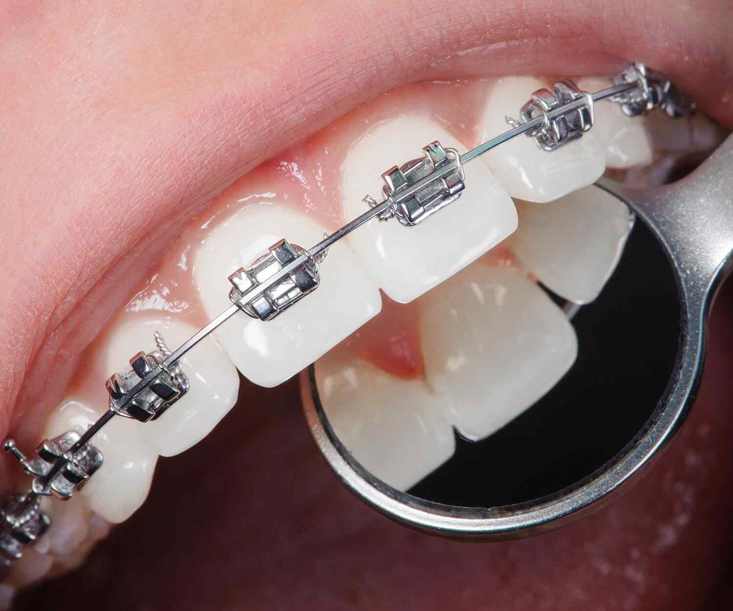https://profiletechnology.com.my/wp-content/uploads/2021/10/card_image_home_03-03.jpg