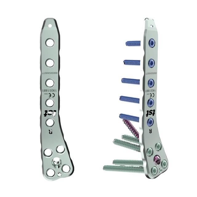 https://profiletechnology.com.my/wp-content/uploads/2025/05/Femur-Osteotomy-Plate.png